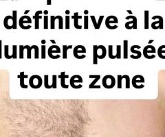 EPILATION DEFINITIVE TOUTE ZONE