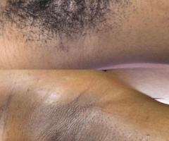 Massage de détente naturiste - 2